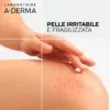 A-Derma Dermalibour+ CICA-Crema Ristrutturante Purificante per Pelle Irritata e Arrossata, 50ml