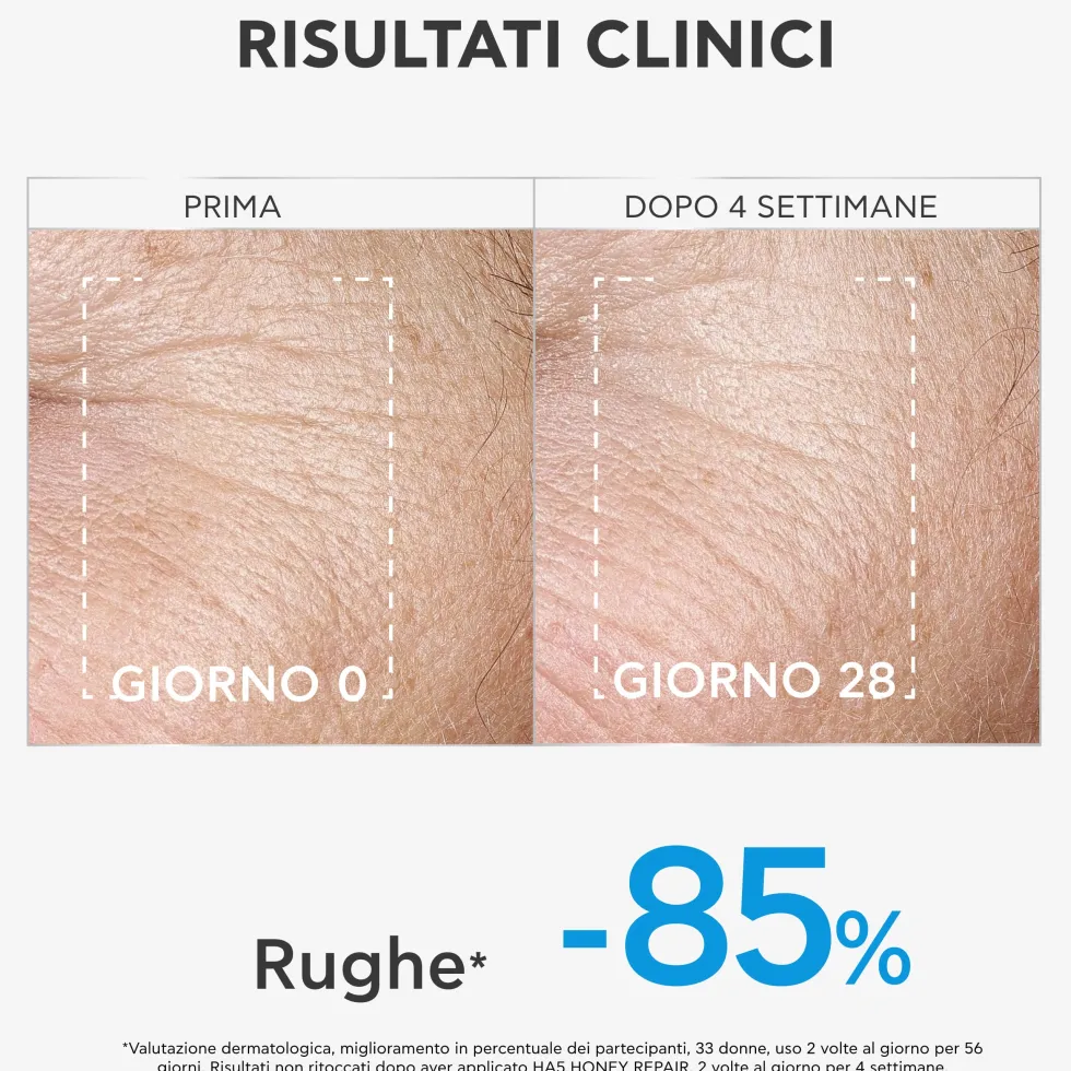 Apivita HA5 Honey Repair - Siero viso idratante e rimpolpante per le rughe, 30 ml