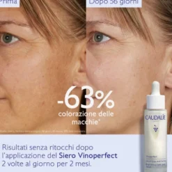 Caudalie Vinoperfect - Siero Illuminante Anti Macchie, 50ml
