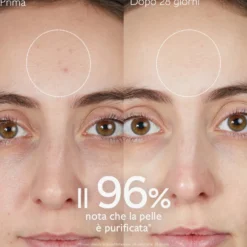 Caudalie Vinopure Gel Detergente Purificante all'Acido Salicilico, 75ml