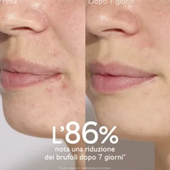 Caudalie Vinopure - Siero all'Acido Salicilico Anti-imperfezioni, 30ml