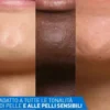 CeraVe Patches Controllo Imperfezioni per Brufoli e Rossori, 22 patches