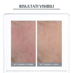 Eucerin Anti-Rose Trattamento Giorno SPF25 - Crema viso per lenire i rossori e la couperose, 50 ml