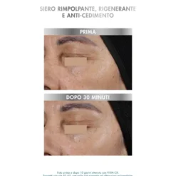 Miamo Age Reverse - Epigenage Shot Siero Rimpolpante Rigenerante Anti-Cedimento, 10 Siringhe da 1ml