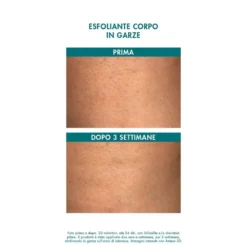 Miamo Body Renew - Alpha Blend 13% Exfoliating Body Gauze, 6 Garze Esfolianti