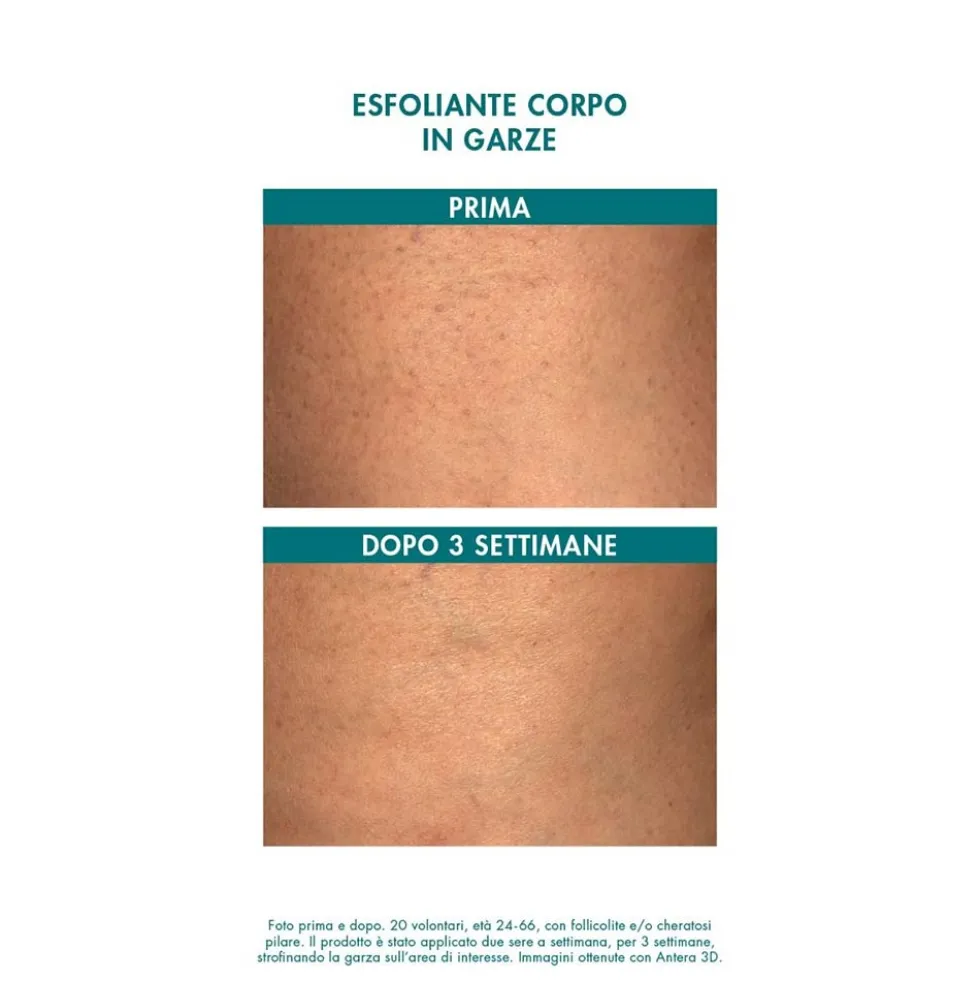 Miamo Body Renew - Alpha Blend 13% Exfoliating Body Gauze, 6 Garze Esfolianti