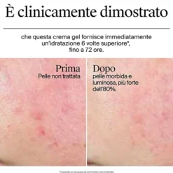 Neutrogena Hydro Boost Crema Gel - Crema idratante per il viso con acido ialuronico, 50 ml