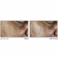 RoC Multi Correxion - Even Tone + Lift Idratante Viso con SPF30, 50ml